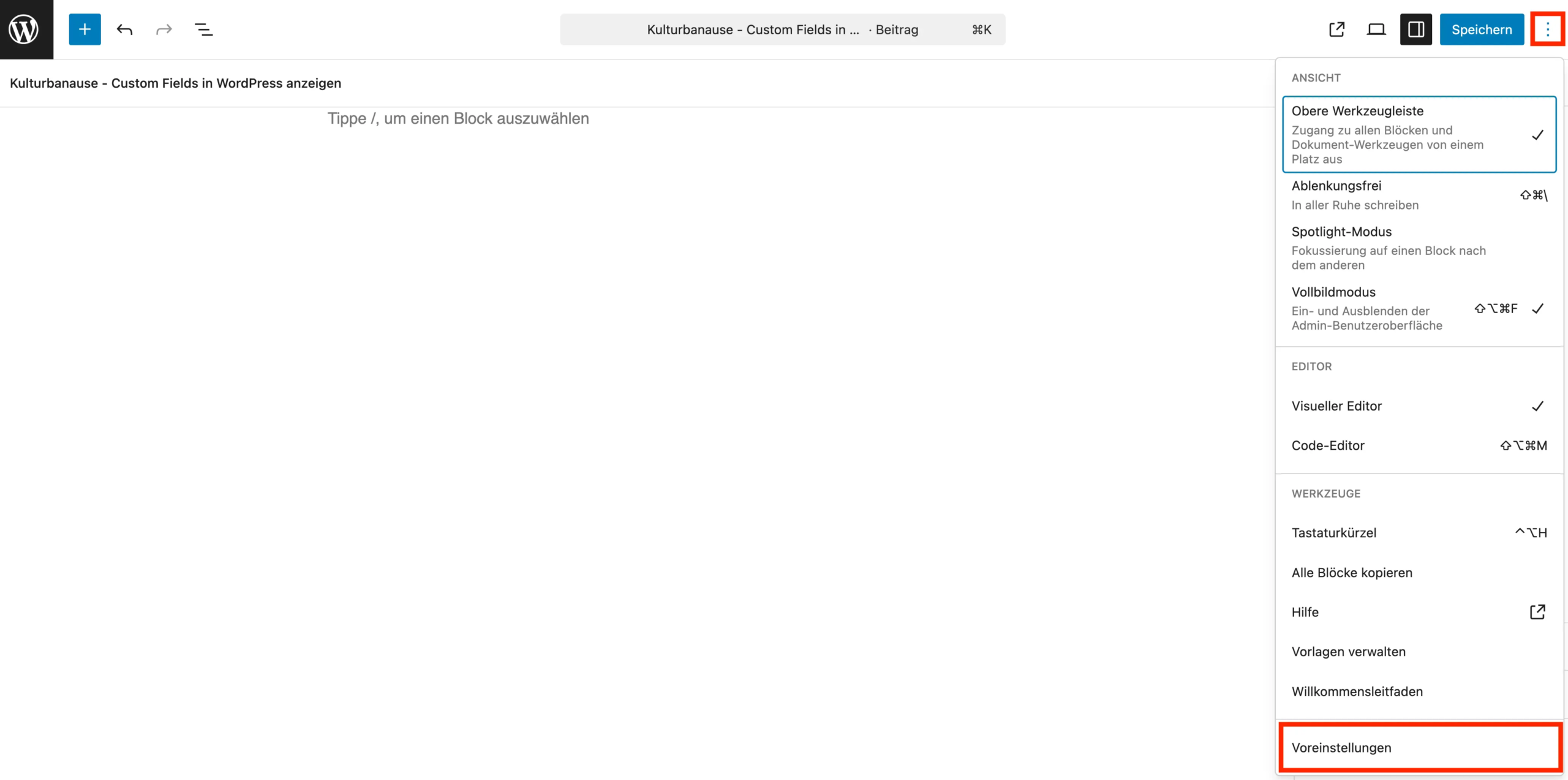 Screenshot des Block Editors